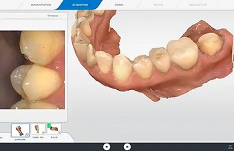 3D Modell eines Kiefers mit Zahnreihe